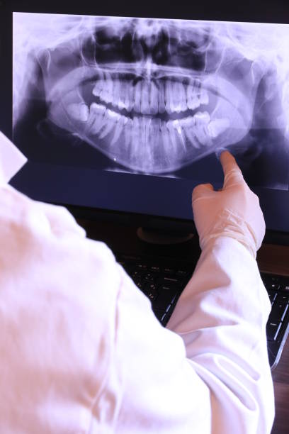 Best Emergency Wisdom Tooth Extraction in Wetherington, OH